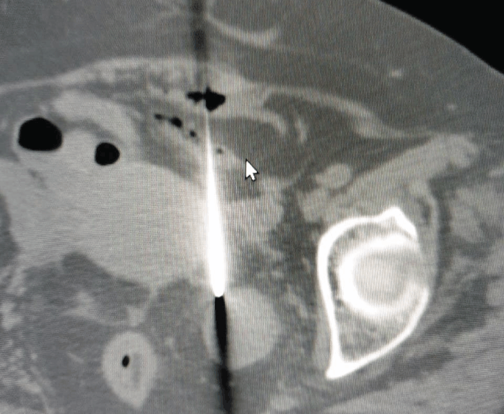 Image-guided diagnostic and therapeutic procedures